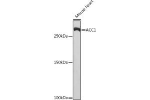 Western blot analysis of extracts of Mouse heart, using  Rabbit mAb (ABIN7265369) at 1:1000 dilution.