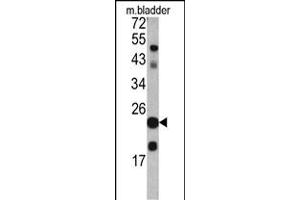 Western blot analysis of TAGLN antibody (C-term) (ABIN390627 and ABIN2840932) in mouse bladder tissue lysates (35 μg/lane). (Transgelin anticorps  (C-Term))