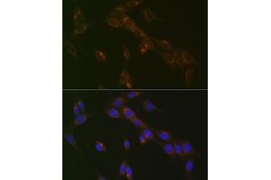 Immunofluorescence analysis of NIH-3T3 cells using RA Rabbit mAb (ABIN7269817) at dilution of 1:100 (40x lens). (RAB9A anticorps)