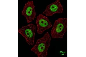 Immunofluorescent analysis of A549 cells, using XRCC1 Antibody (Center) (ABIN651735 and ABIN2840381).