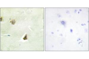 Immunohistochemistry analysis of paraffin-embedded human brain tissue, using DUSP6 Antibody. (DUSP6 anticorps  (AA 61-110))