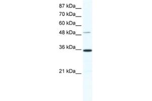 Western Blotting (WB) image for anti-Zinc Finger Protein 610 (ZNF610) antibody (ABIN2461321) (ZNF610 anticorps)