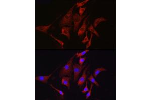 Immunofluorescence analysis of NIH/3T3 cells using TMPRSS2 Rabbit pAb (ABIN6132728, ABIN6149286, ABIN6149287 and ABIN6219138) at dilution of 1:50 (40x lens). (TMPRSS2 anticorps  (AA 140-400))