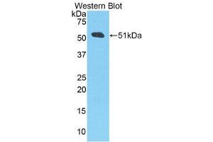 Western Blotting (WB) image for anti-Amyloid beta (A4) Precursor Protein (APP) (AA 672-711) antibody (ABIN1858065) (APP anticorps  (AA 672-711))