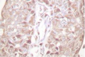 Image no. 2 for anti-SUMO1/sentrin Specific Peptidase 1 (SENP1) antibody (ABIN271955) (SENP1 anticorps)