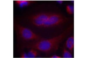 Image no. 1 for anti-Synuclein, alpha (SNCA) (AA 131-135) antibody (ABIN401571) (SNCA anticorps  (AA 131-135))