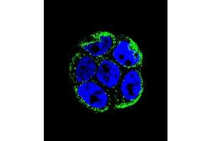 Confocal immunofluorescent analysis of VILL Antibody (Center) (ABIN656022 and ABIN2845397) with WiDr cell followed by Alexa Fluor 488-conjugated goat anti-rabbit lgG (green).