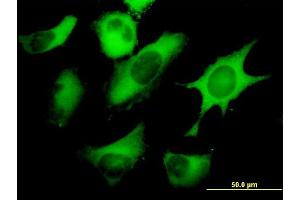 Immunofluorescence of monoclonal antibody to FASN on HeLa cell. (Fatty Acid Synthase anticorps  (AA 1-439))