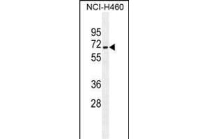 ZSCAN5B Antibody (C-term) (ABIN655366 and ABIN2844923) western blot analysis in NCI- cell line lysates (35 μg/lane).