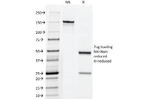 SDS-PAGE Analysis Purified Fascin-1 Mouse Monoclonal Antibody (FSCN1/418).