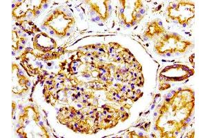 IHC image of ABIN7127272 diluted at 1:100 and staining in paraffin-embedded human kidney tissue performed on a Leica BondTM system.