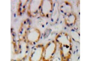 Used in DAB staining on fromalin fixed paraffin-embedded Kidney tissue (PKN1 anticorps  (AA 615-874))