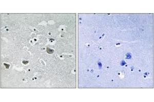Immunohistochemistry analysis of paraffin-embedded human brain tissue, using SREBP-1 (Ab-439) Antibody. (SREBF1 anticorps  (AA 405-454))