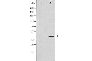 Western blot analysis of extracts of HepG2 cells, using HLA-DRB3 antibody.