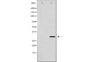 Western blot analysis of extracts of HepG2 cells, using HLA-DRB3 antibody. (HLA-DRB3 anticorps)