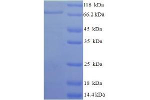 SDS-PAGE (SDS) image for Apoptosis-Inducing Factor, Mitochondrion-Associated, 1 (AIFM1) (AA 103-612), (partial) protein (His-SUMO Tag) (ABIN5709025)