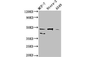 Western Blot Positive WB detected in: MCF-7 whole cell lysate, Ntera-2 whole cell lysate, A549 whole cell lysate All lanes: NANOG antibody at 1:500 Secondary Goat polyclonal to Mouse IgG at 1/10000 dilution Predicted band size: 35, 33 kDa Observed band size: 46, 40 kDa (Nanog anticorps  (AA 1-305))