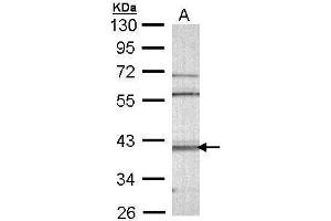 WB Image Sample (30 ug of whole cell lysate) A: Molt-4 , 10% SDS PAGE antibody diluted at 1:1000 (CAMK1D anticorps)