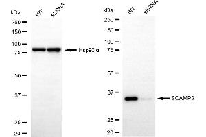 Western blotting analysis using SCAMP2 antibody (ABIN7800289). (SCAMP2 anticorps)