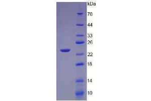 Image no. 1 for Lymphotoxin-alpha (LTA) (AA 35-205) (Active) protein (His tag) (ABIN6239734)