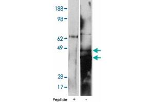 Western blot using DEGS2 polyclonal antibody on human kidney cell lysate at 15 ug/lane. (DEGS2 anticorps)