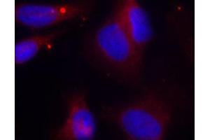 Immunofluorescence (IF) image for anti-zeta-Chain (TCR) Associated Protein Kinase 70kDa (ZAP70) (pTyr319) antibody (ABIN3023646) (ZAP70 anticorps  (pTyr319))