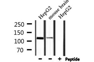 Western blot analysis of extracts from HepG2,mouse brain, using IARS2 Antibody.