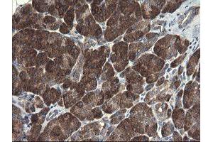 Image no. 7 for anti-Polymerase (RNA) III (DNA Directed) Polypeptide C (62kD) (POLR3C) antibody (ABIN1500340)