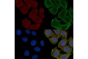 anti-HCG beta antibody