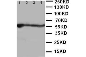 Anti-ALDH2 antibody, Western blotting Lane 1: Rat Liver Tissue Lysate Lane 2: Rat Intestine Tissue Lysate Lane 3: Rat Lung Tissue Lysate Lane 4: Rat Kidney Tissue Lysate