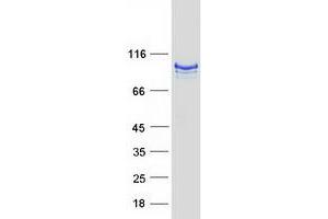 Validation with Western Blot