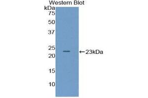 Western Blotting (WB) image for anti-Pituitary Adenylate Cyclase Activating Peptide (AA 1-175) antibody (ABIN1857915) (Pituitary Adenylate Cyclase Activating Peptide (AA 1-175) anticorps)