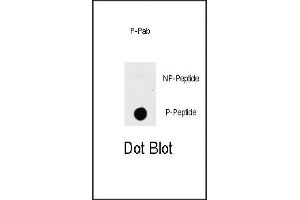 Dot blot analysis of anti-K1-p Phospho-specific b (ABIN389799 and ABIN2839695) on nitrocellulose membrane.
