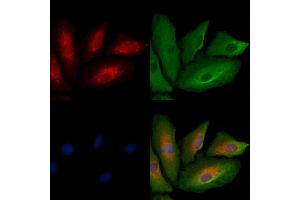 ABIN6261180 and ABIN6278834 staining  cells by IF/ICC. (COX1 anticorps  (C-Term))