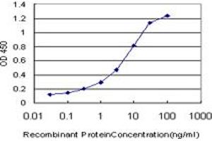 Detection limit for recombinant GST tagged SORD is approximately 0.