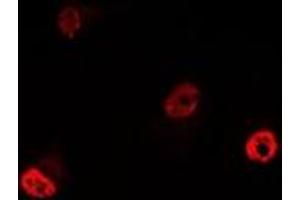 Immunofluorescent analysis of YT521-B staining in MCF7 cells. (YTHDC1 anticorps)