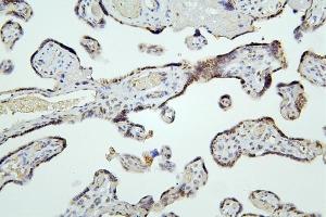 IHC analysis of HDAC5 using anti-HDAC5 antibody (ABIN7599922). (HDAC5 anticorps  (AA 13-1107))