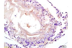 Formalin-fixed and paraffin embedded rat testis labeled with Anti-LDHC/Cancer,testis antigen 32 Polyclonal Antibody, Unconjugated (ABIN704696) at 1:200 followed by conjugation to the secondary antibody and DAB staining.