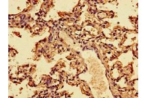 Immunohistochemistry of paraffin-embedded human lung tissue using ABIN7156561 at dilution of 1:100 (IFNA2 anticorps  (AA 24-188))