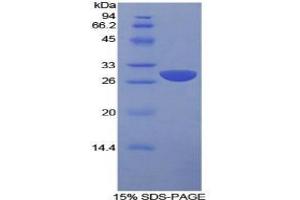 SDS-PAGE analysis of Human SLAMF1 Protein. (SLAMF1 Protéine)