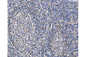 IHC analysis of Glutathione Reductase using anti-Glutathione Reductase antibody (ABIN5693151). (Glutathione Reductase anticorps  (AA 256-522))