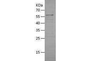 Western Blotting (WB) image for rho Guanine Nucleotide Exchange Factor (GEF) 12 (ARHGEF12) (AA 1268-1484) protein (His-IF2DI Tag) (ABIN7124864)