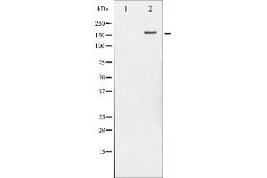 Western blot analysis of HER2 phosphorylation expression in EGF treated MDA-MB-231 whole cell lysates,The lane on the left is treated with the antigen-specific peptide.