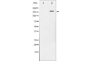 Western blot analysis of HER2 phosphorylation expression in EGF treated MDA-MB-231 whole cell lysates,The lane on the left is treated with the antigen-specific peptide. (ErbB2/Her2 anticorps  (pTyr877))