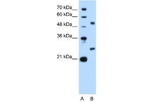 WB Suggested Anti-BCL2L1 Antibody Titration: 2. (BCL2L1 anticorps  (N-Term))