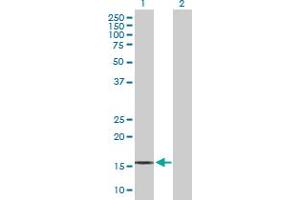 Western Blot analysis of IL21 expression in transfected 293T cell line by IL21 MaxPab polyclonal antibody.