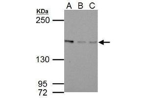 WB Image Sample (30 ug of whole cell lysate)          A: NIH-3T3         B: JC         C: BCL-1         5% SDS PAGE          antibody diluted at 1:1000          (BLM anticorps  (C-Term))