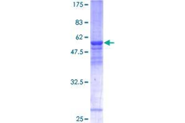 THOC6 Protein (AA 1-317) (GST tag)