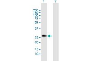Western Blot analysis of ZC4H2 expression in transfected 293T cell line by ZC4H2 MaxPab polyclonal antibody. (ZC4H2 anticorps  (AA 1-224))