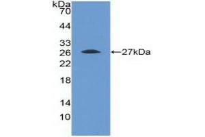 Detection of Recombinant FGFR4, Human using Polyclonal Antibody to Fibroblast Growth Factor Receptor 4 (FGFR4)